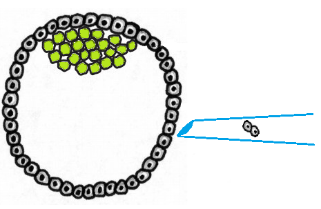 pgd