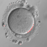 endo 2