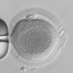 endo9