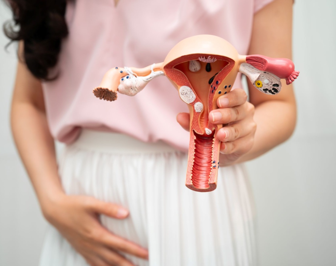 dieta przy pcos